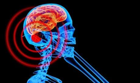 Dangers of cellphone radiation. Part 1