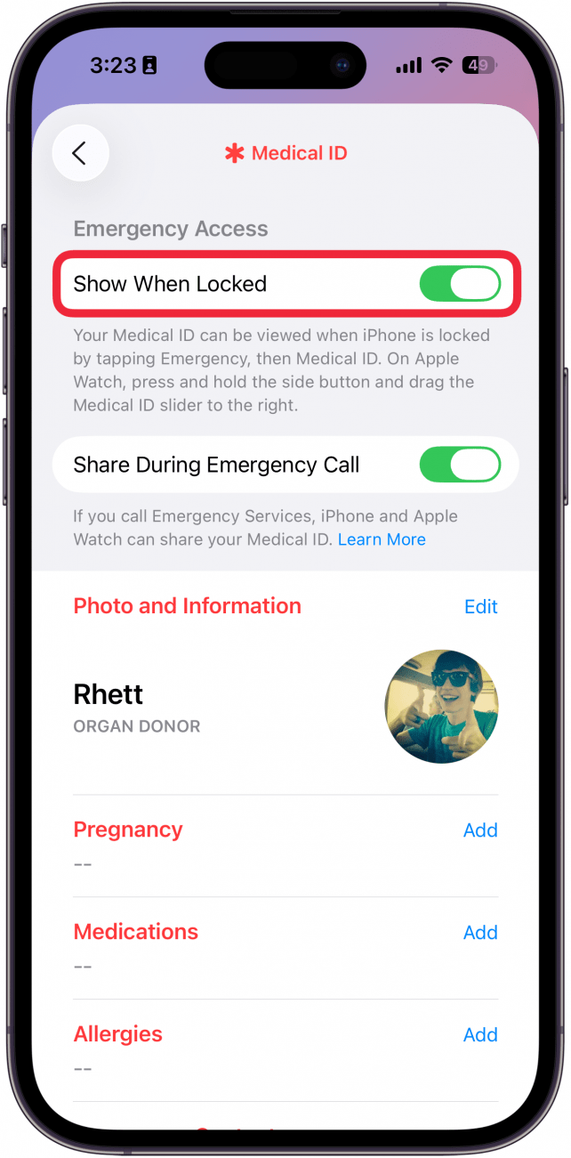 a screenshot of medical id settings in the health app with a red box around the show when locked toggle