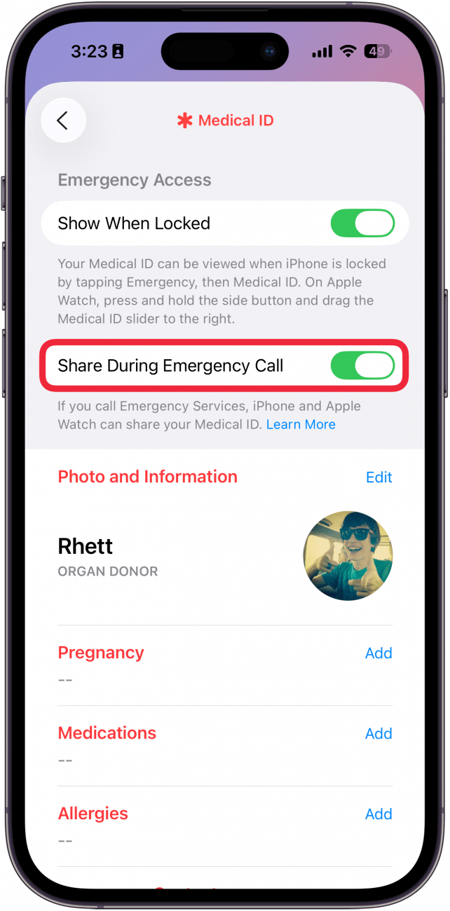 a screenshot of medical id settings in the health app with a red box around the share during emergency call toggle