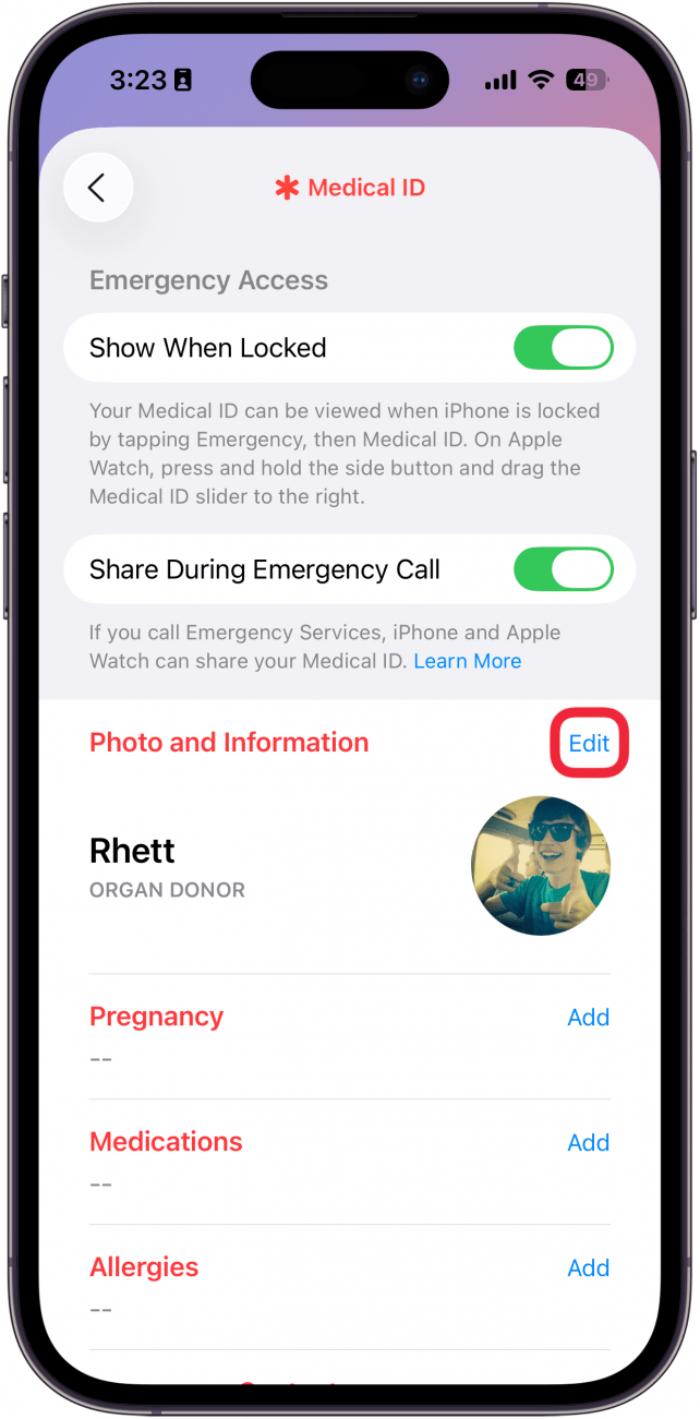 a screenshot of medical id settings in the health app with a red box around the edit button