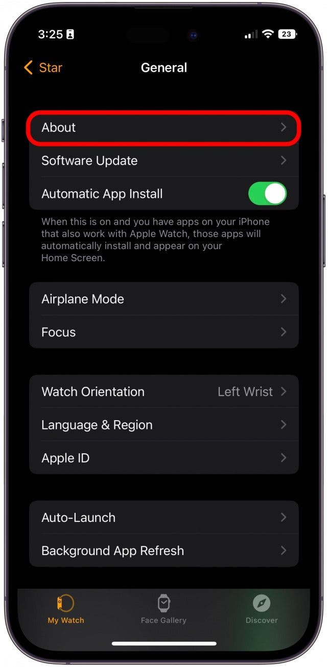 How to Free Up Apple Watch Storage (7 Easy Ways)