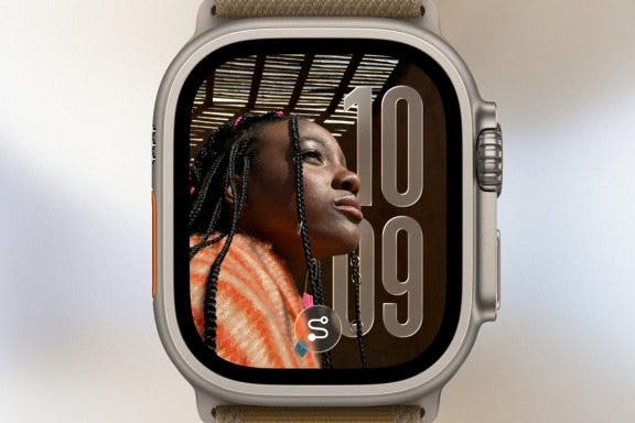 Image for article: The watchOS 26 Update Brings Apple Intelligence to Your Wrist