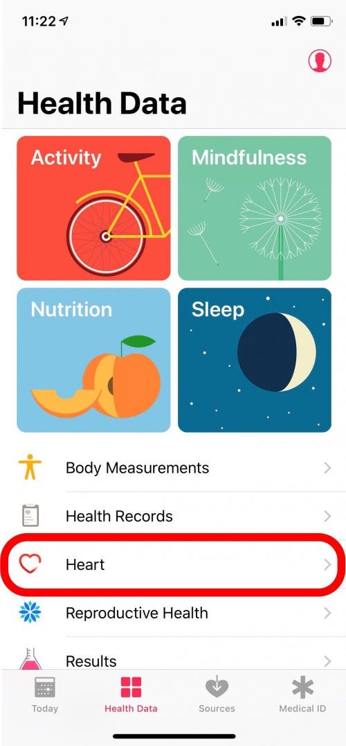 How to Set Up & Use the ECG Feature on Your Apple Watch
