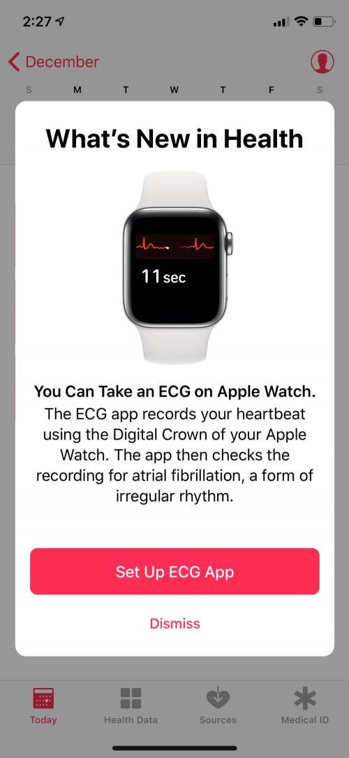 How to Set Up & Use the ECG Feature on Your Apple Watch